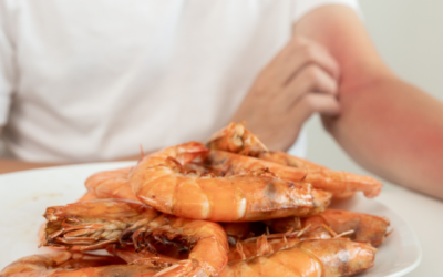 Food Allergy vs. Food Intolerance: What’s the Difference